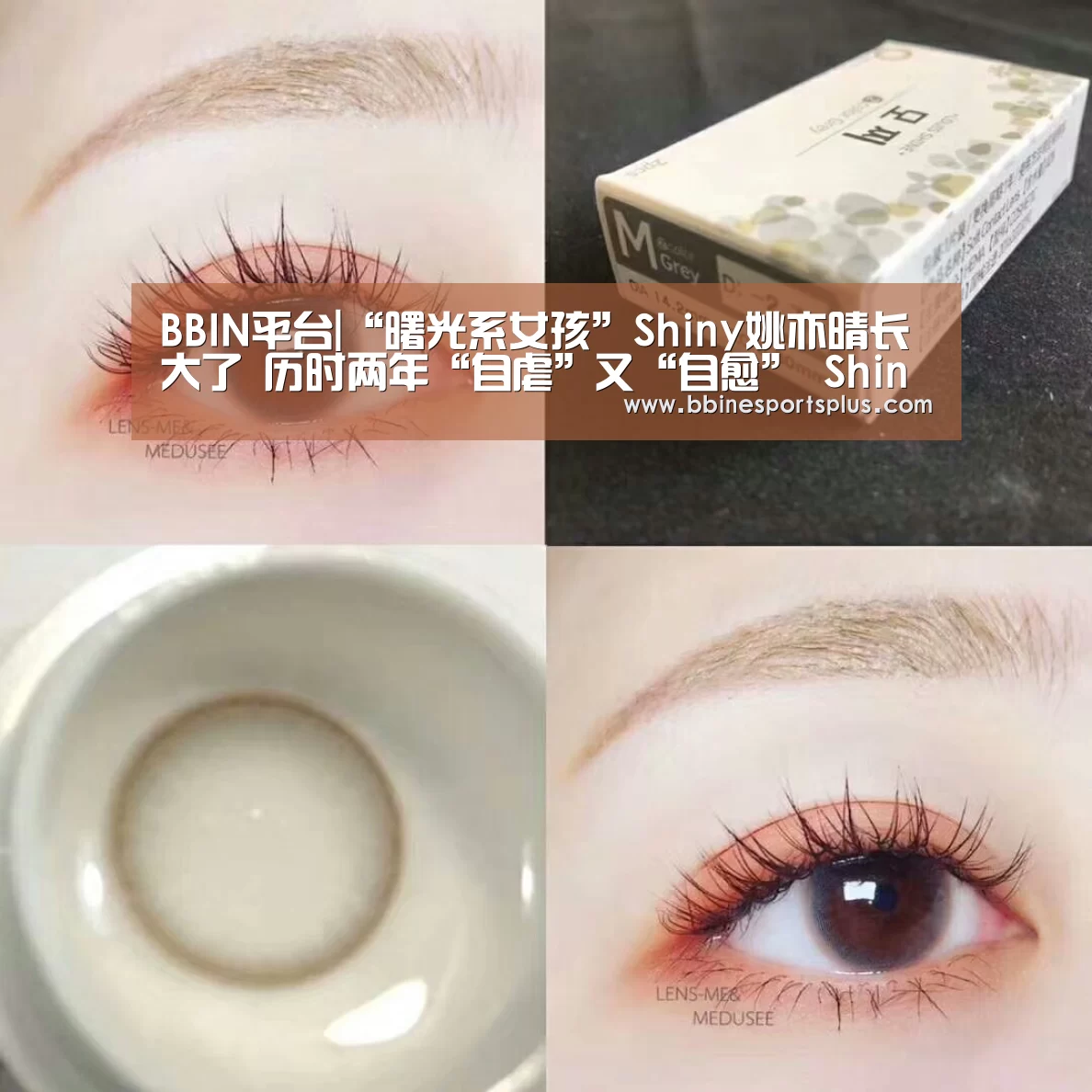 BBIN平台|“曙光系女孩”Shiny姚亦晴长大了 历时两年“自虐”又“自愈” Shiny活出自我(图1) BBIN捕鱼